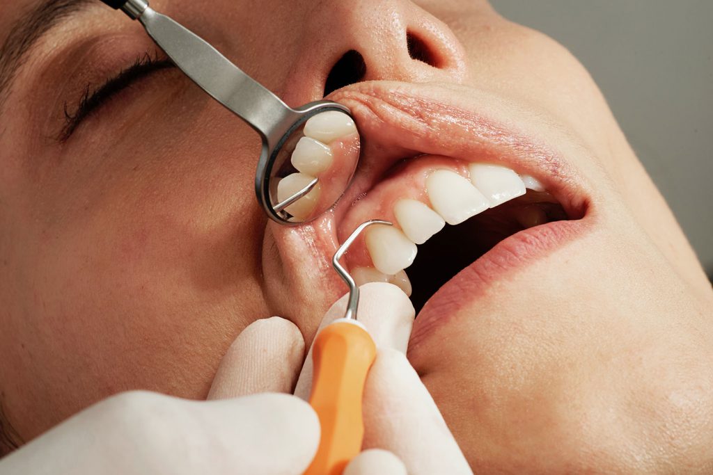 caroline lm 8BkF0sTC6Uo unsplash Faculty of Dentistry, Chulalongkorn University