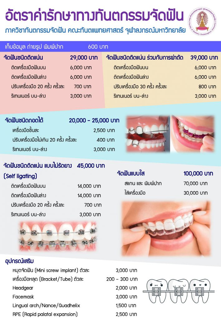 price คณะทันตแพทยศาสตร์ จุฬาลงกรณ์มหาวิทยาลัย