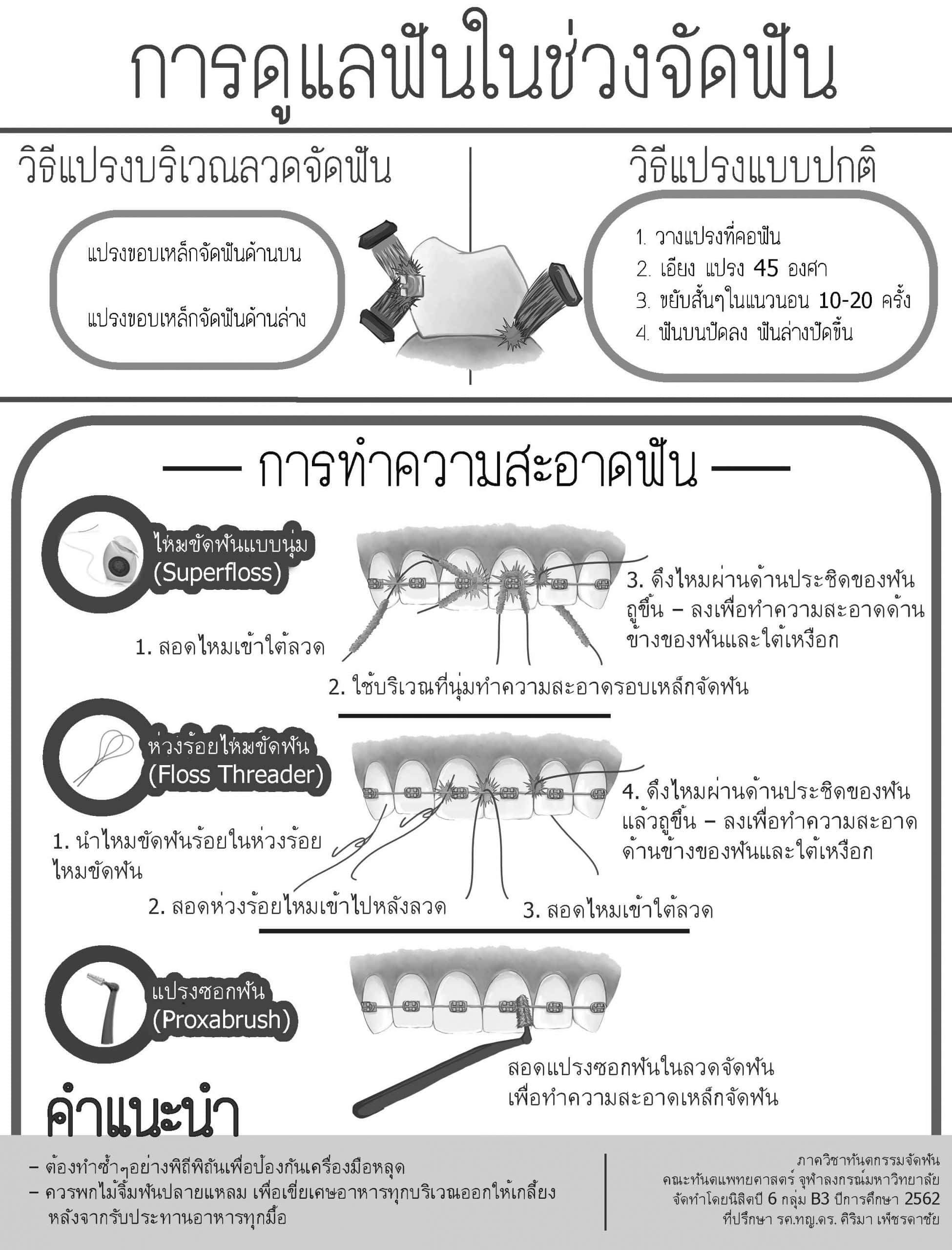 orthobw scaled คณะทันตแพทยศาสตร์ จุฬาลงกรณ์มหาวิทยาลัย