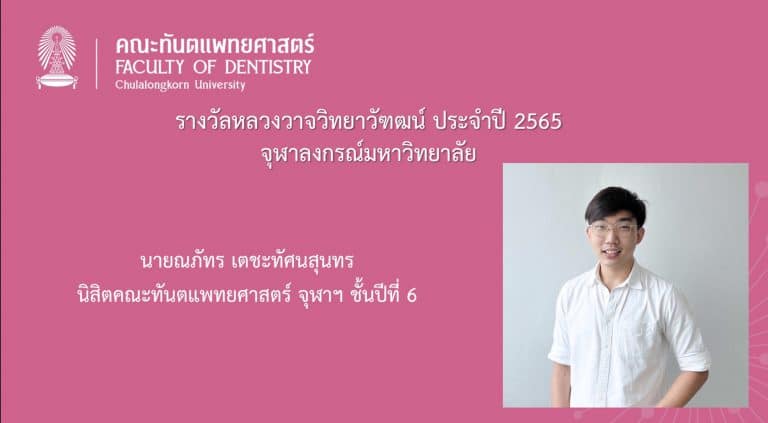 คณะทันตแพทยศาสตร์ จุฬาลงกรณ์มหาวิทยาลัย ขอแสดงความยินดีกับ นายณภัทร เตชะทัศนสุนทร นิสิตทันตแพทย์ ชั้นปีที่ 6 ที่ได้รับรางวัลหลวงวาจวิทยาวัฑฒน์ ประจำปี 2565 จากทันตแพทยสมาคมแห่งประเทศไทย ในพระบรมราชูปถัมถ์ ในการประชุมวิชาการ ครั้งที่ 113 (1/2565)