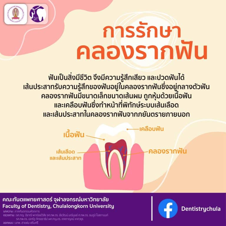 สาระน่ารู้กับทันตะจุฬาฯ : การรักษาคลองรากฟัน