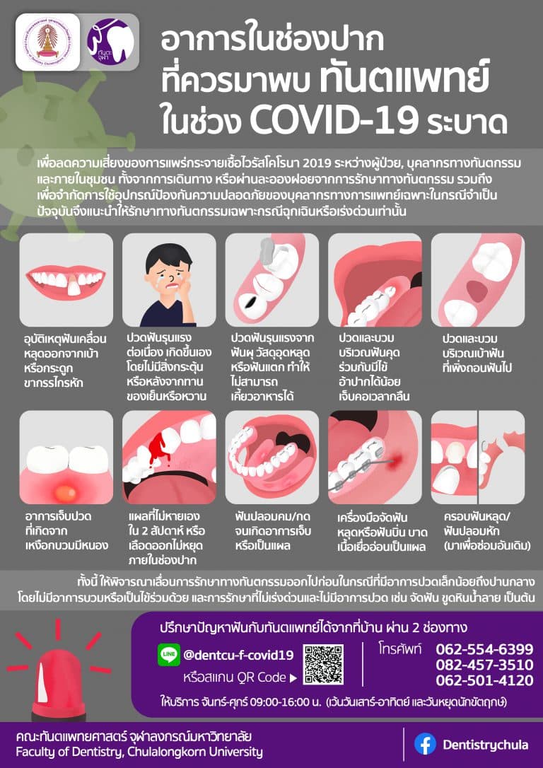 สาระน่ารู้กับทันตะจุฬาฯ : อาการในช่องปากที่ควรมาพบทันตแพทย์ ในช่วงมีการระบาดของ COVID-19