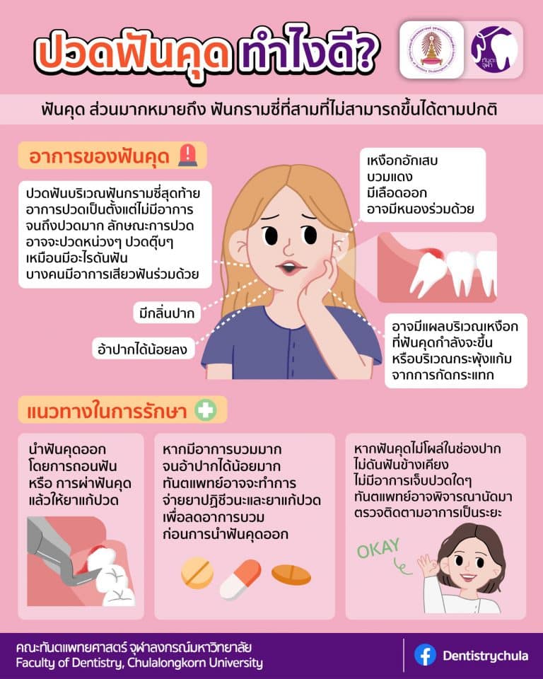 สาระน่ารู้กับทันตะจุฬาฯ : ปวดฟันคุด ทำไงดี?