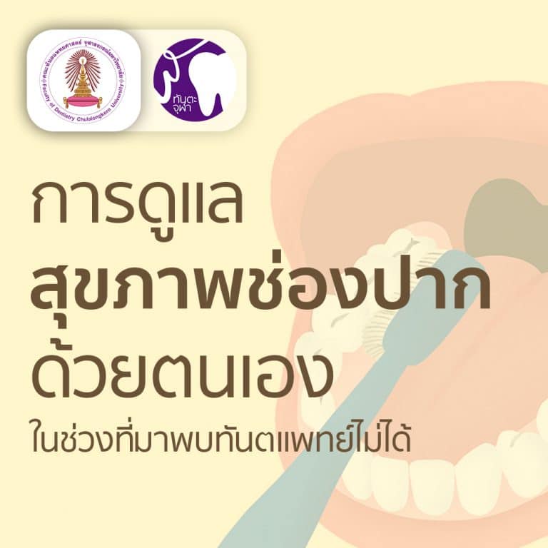 สาระน่ารู้กับทันตะจุฬาฯ : การดูแลสุขภาพช่องปากด้วยตนเอง ในช่วงที่มาพบทันตแพทย์ไม่ได้