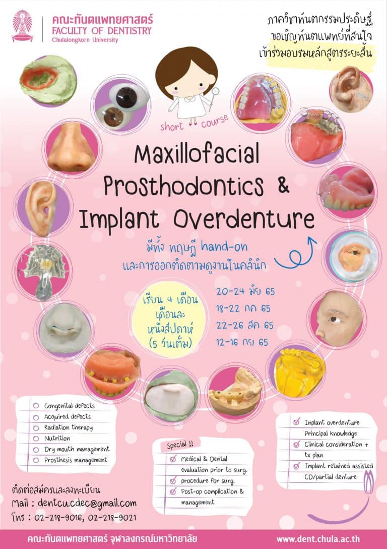ภาควิชาทันตกรรมประดิษฐ์ คณะทันตแพทยศาสตร์ จุฬาฯ ขอเชิญทันตแพทย์ที่สนใจ เข้าร่วมอบรมหลักสูตรระยะสั้น Maxillofacial Prosthodontics & Implant Overdenture