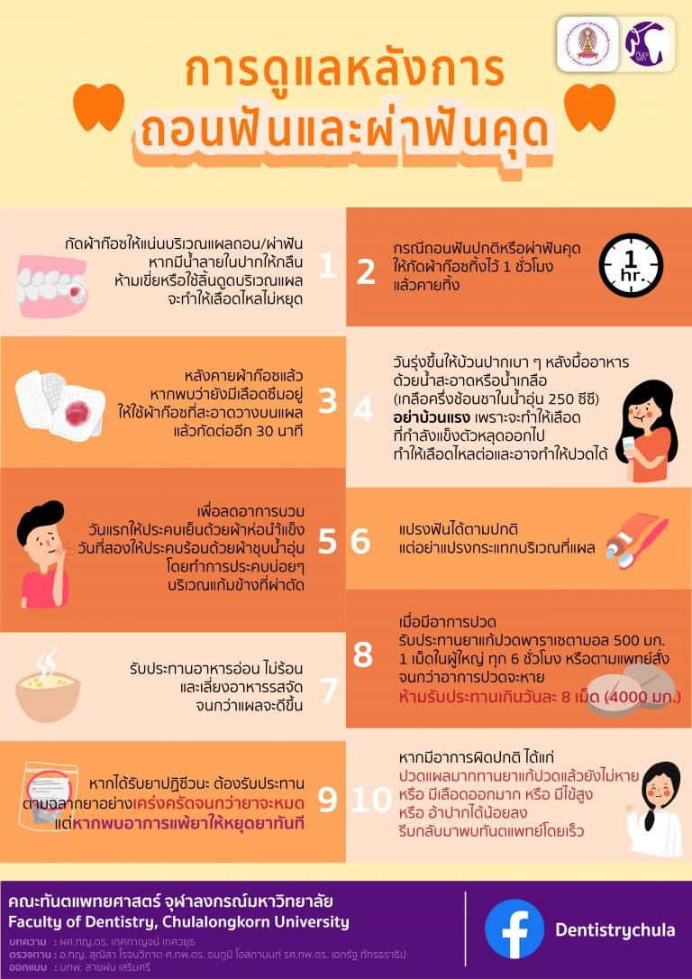 สาระน่ารู้กับทันตะจุฬาฯ : การดูแลหลังการถอนฟันและผ่าฟันคุด