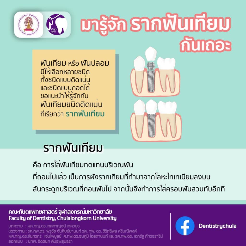 img 1 1641 คณะทันตแพทยศาสตร์ จุฬาลงกรณ์มหาวิทยาลัย