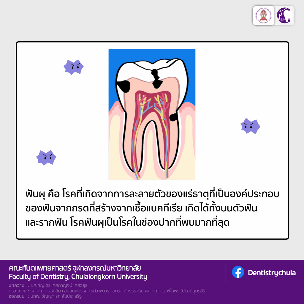 img 1 2128 คณะทันตแพทยศาสตร์ จุฬาลงกรณ์มหาวิทยาลัย