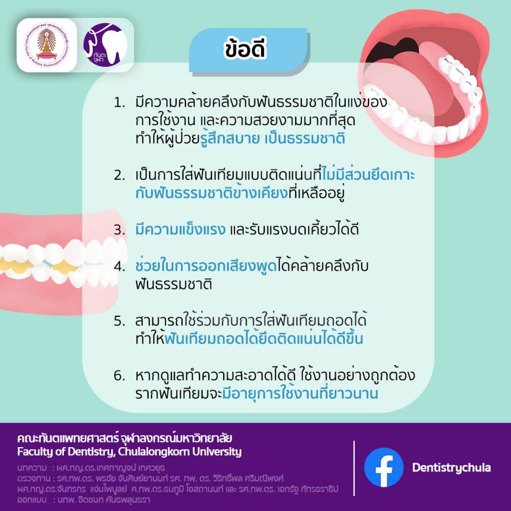 img 2 1641 คณะทันตแพทยศาสตร์ จุฬาลงกรณ์มหาวิทยาลัย