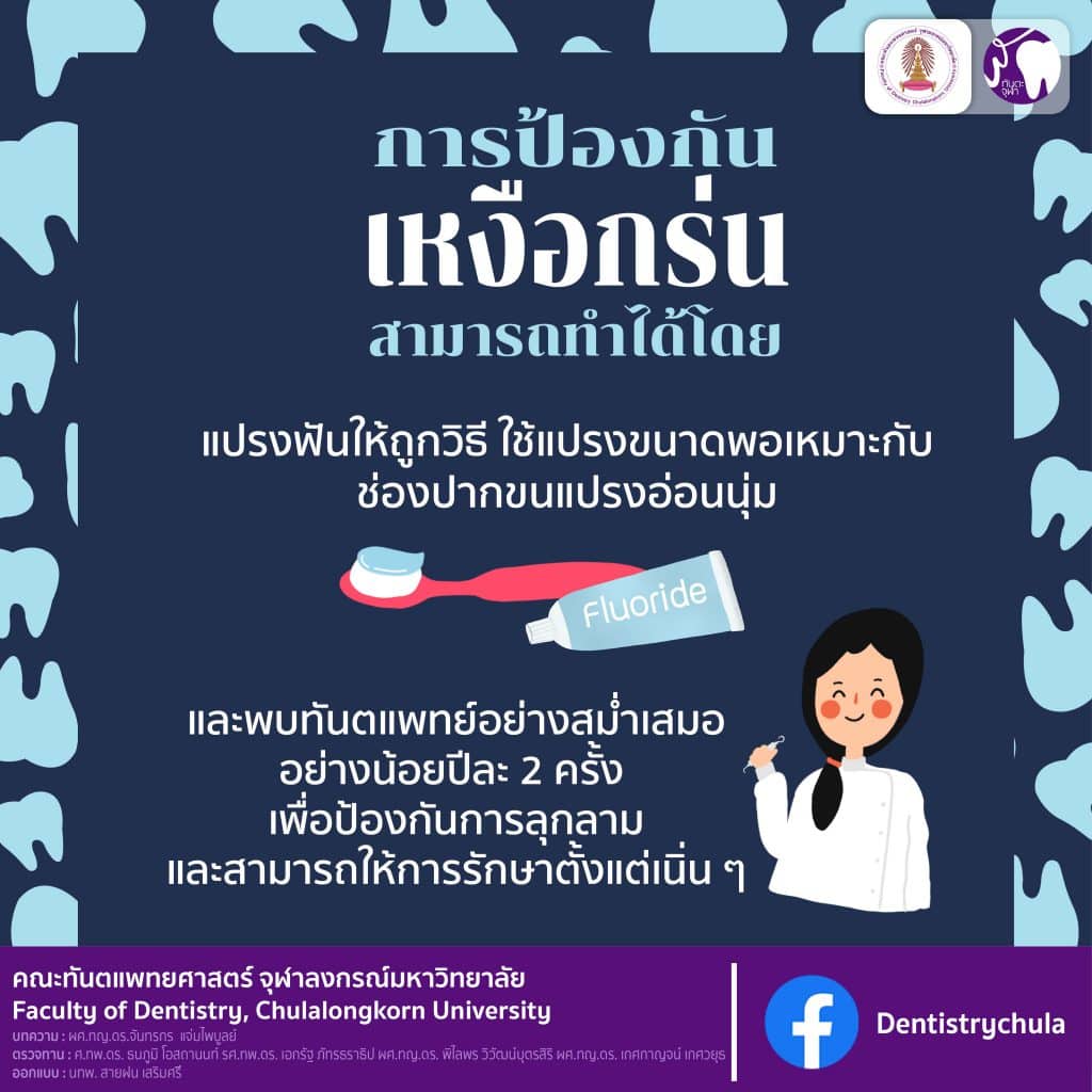 img 3 0106 คณะทันตแพทยศาสตร์ จุฬาลงกรณ์มหาวิทยาลัย