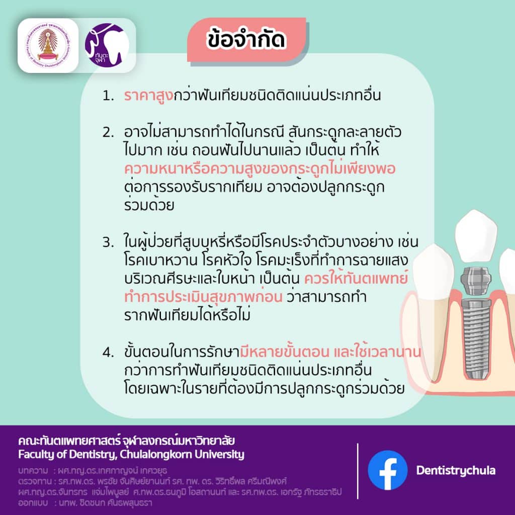 img 3 1641 คณะทันตแพทยศาสตร์ จุฬาลงกรณ์มหาวิทยาลัย