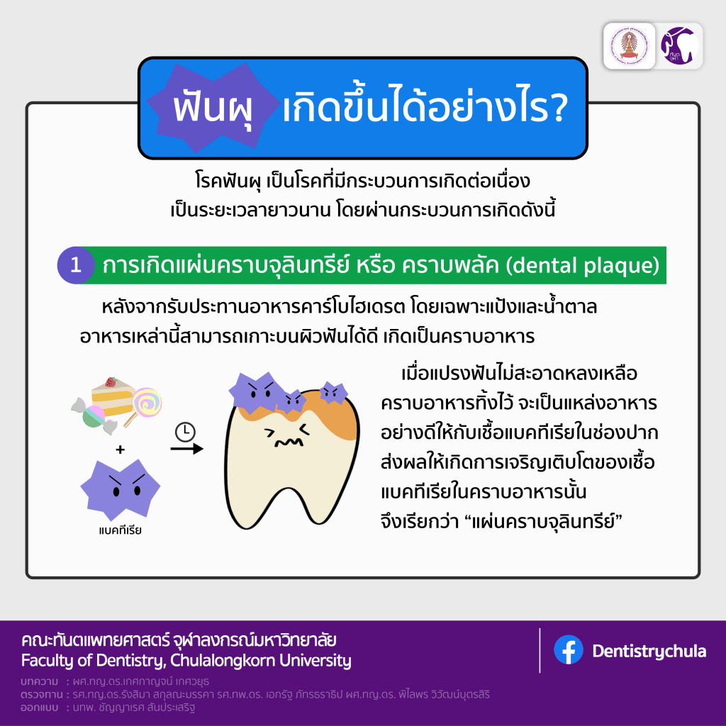 img 3 2128 คณะทันตแพทยศาสตร์ จุฬาลงกรณ์มหาวิทยาลัย