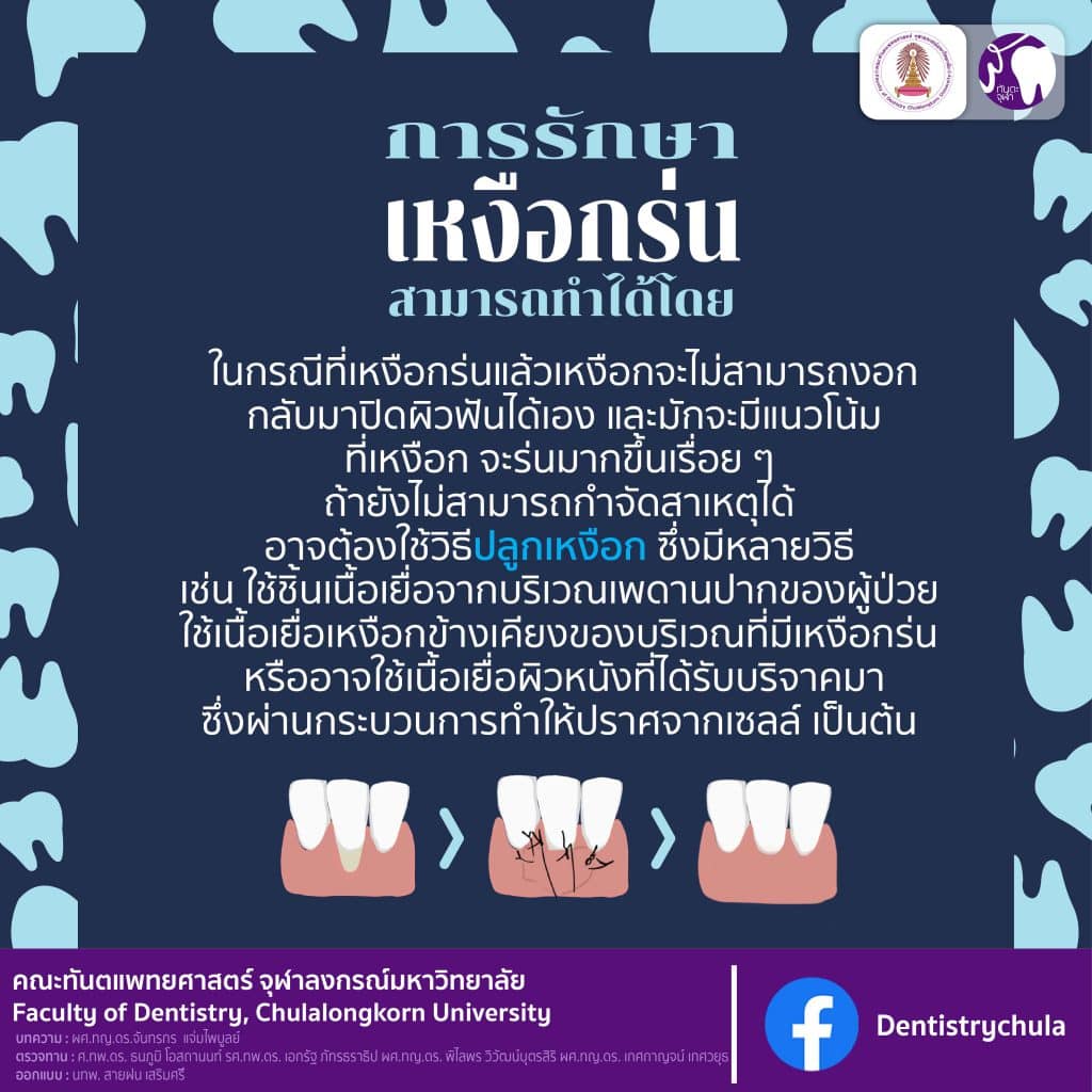 img 4 0106 คณะทันตแพทยศาสตร์ จุฬาลงกรณ์มหาวิทยาลัย