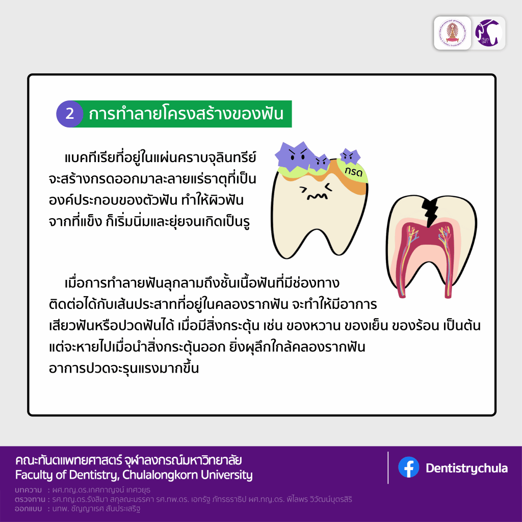 img 4 2128 คณะทันตแพทยศาสตร์ จุฬาลงกรณ์มหาวิทยาลัย