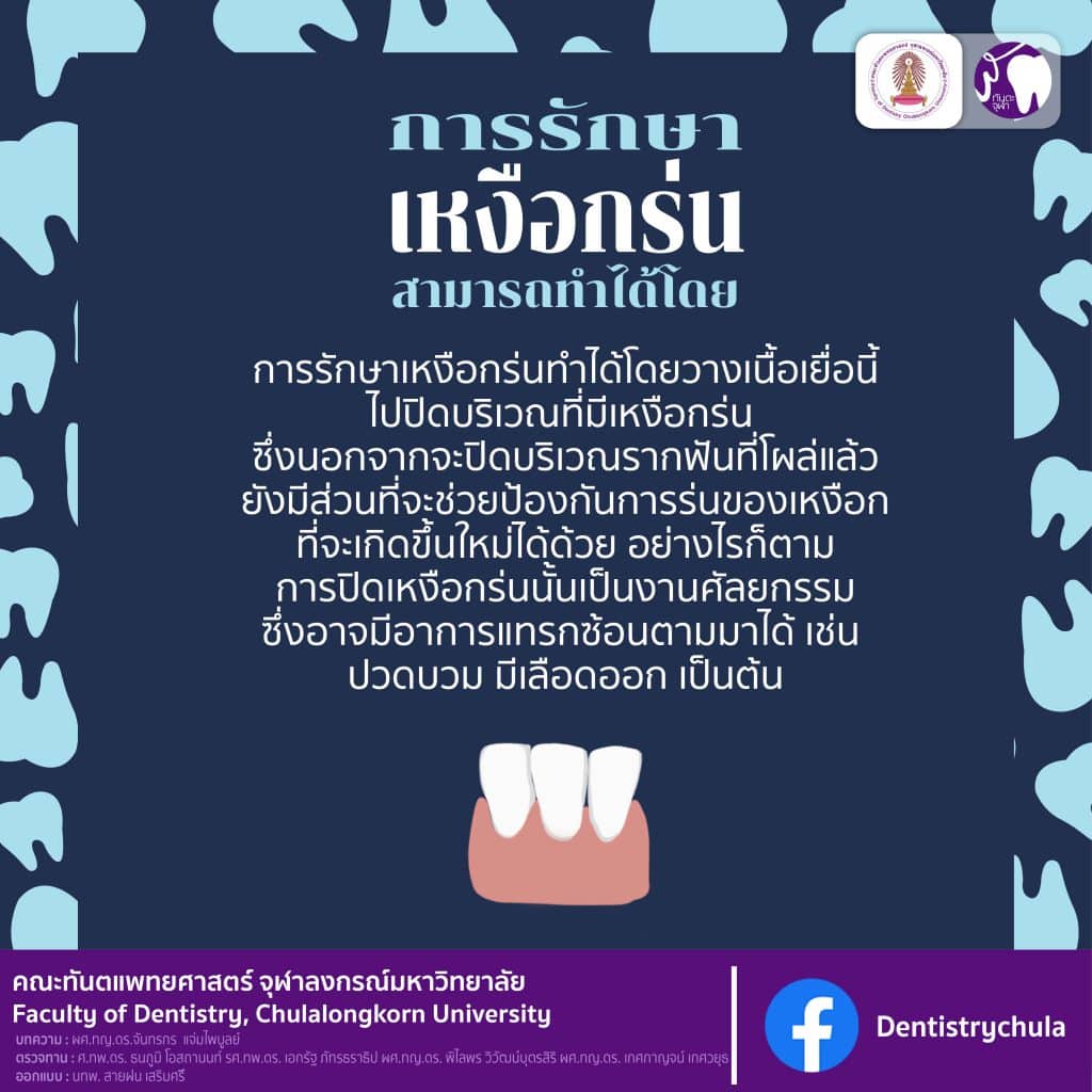 img 5 0158 คณะทันตแพทยศาสตร์ จุฬาลงกรณ์มหาวิทยาลัย