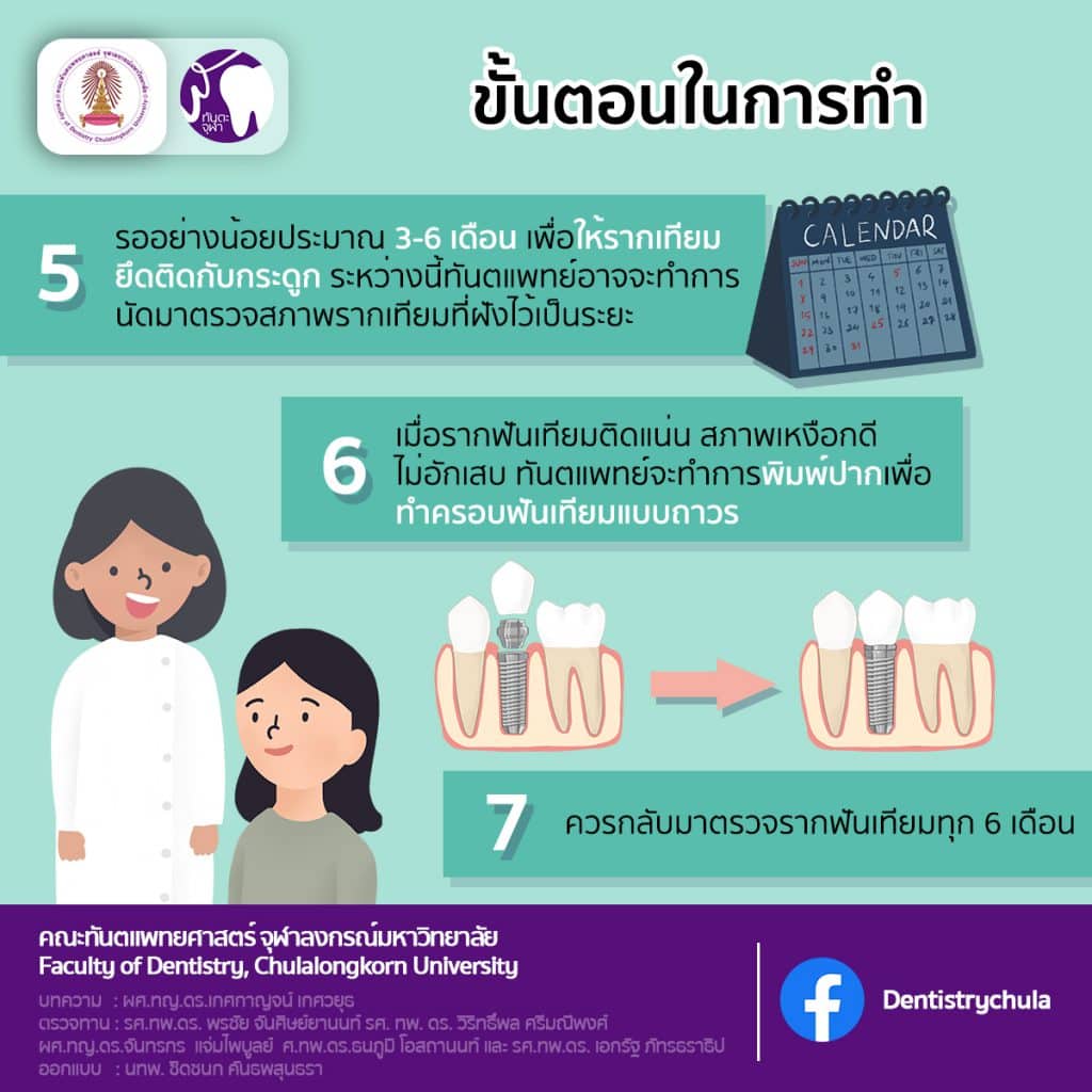 img 6 1706 คณะทันตแพทยศาสตร์ จุฬาลงกรณ์มหาวิทยาลัย