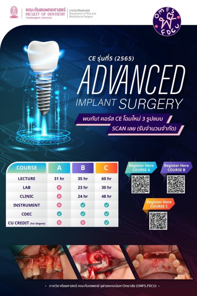 AEGD Advanced Implant Surgery Poster คณะทันตแพทยศาสตร์ จุฬาลงกรณ์มหาวิทยาลัย