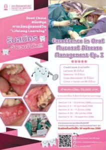 Excellence in oral mucosal disease management Ep I Poster คณะทันตแพทยศาสตร์ จุฬาลงกรณ์มหาวิทยาลัย
