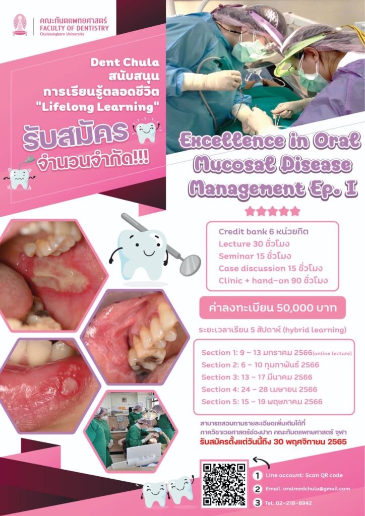 Excellence in oral mucosal disease management Ep I Poster คณะทันตแพทยศาสตร์ จุฬาลงกรณ์มหาวิทยาลัย