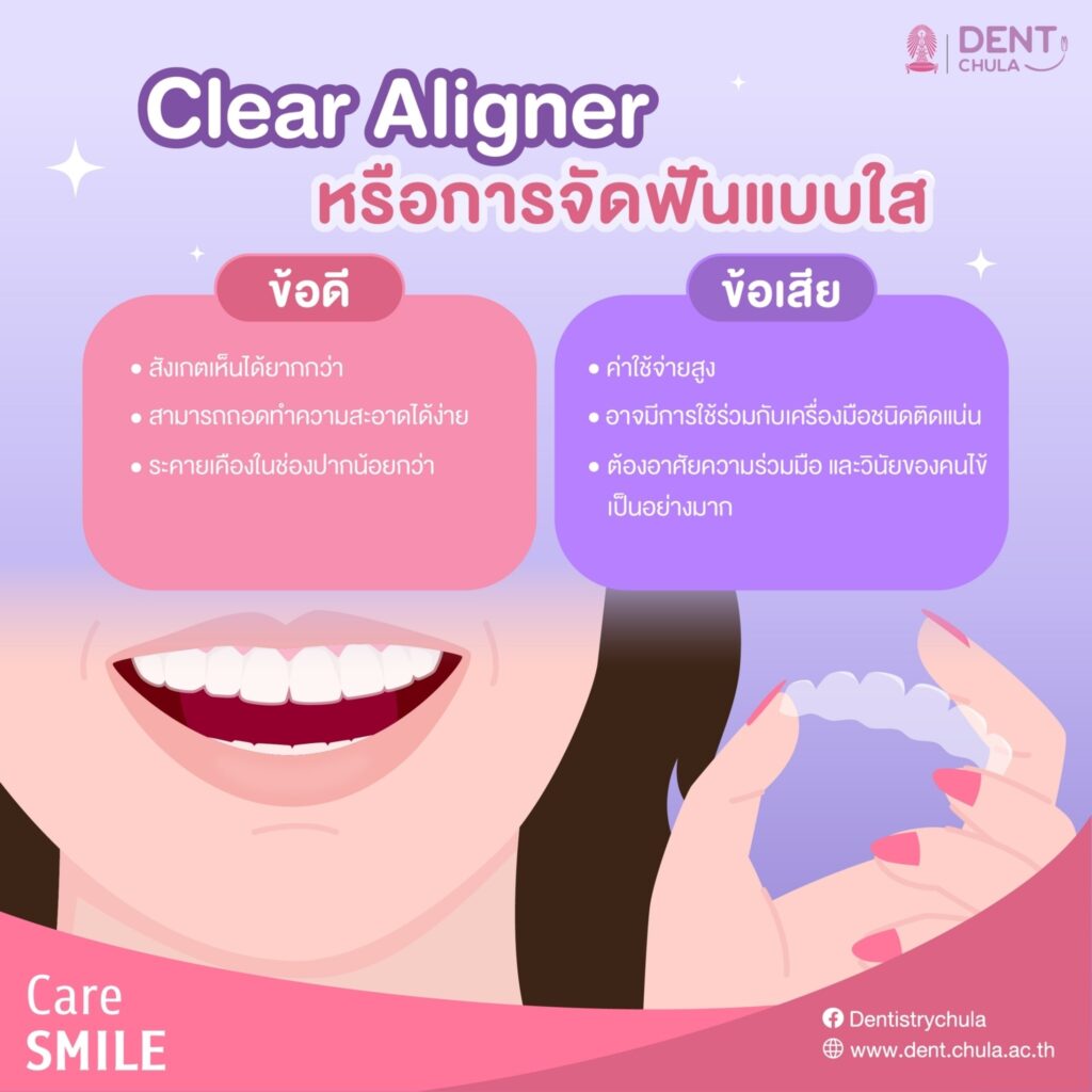 LINE ALBUM Clear Aligner 240123 5 คณะทันตแพทยศาสตร์ จุฬาลงกรณ์มหาวิทยาลัย