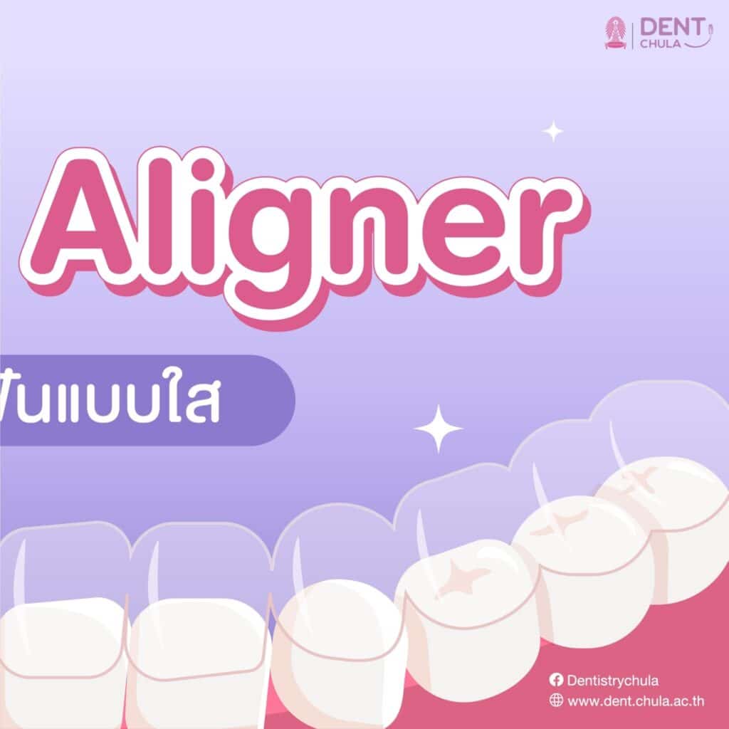 LINE ALBUM Clear Aligner 240123 7 คณะทันตแพทยศาสตร์ จุฬาลงกรณ์มหาวิทยาลัย