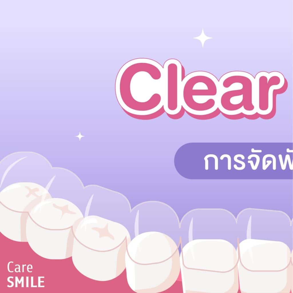 LINE ALBUM Clear Aligner 240123 8 คณะทันตแพทยศาสตร์ จุฬาลงกรณ์มหาวิทยาลัย