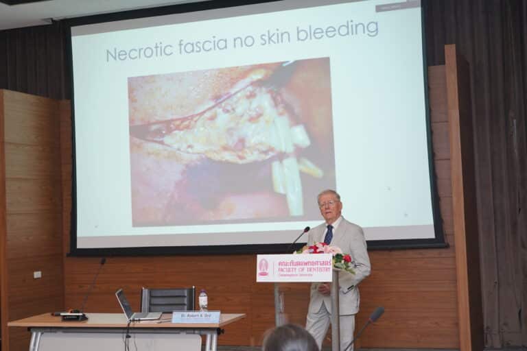 Distinguished Speaker Dr. Robert A. Ord Shares Expertise on “Management of Ameloblastoma” at Chulalongkorn University