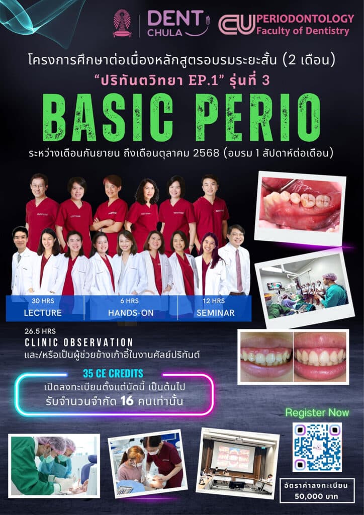 poster basic perio ep1 3 คณะทันตแพทยศาสตร์ จุฬาลงกรณ์มหาวิทยาลัย