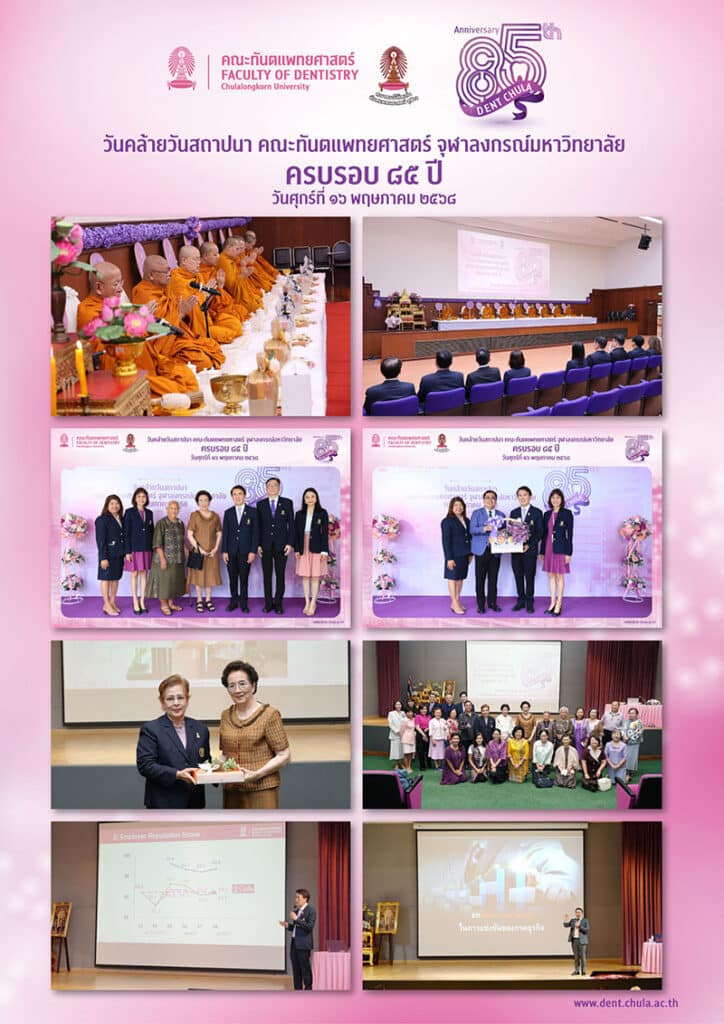 dent chula 85th day คณะทันตแพทยศาสตร์ จุฬาลงกรณ์มหาวิทยาลัย
