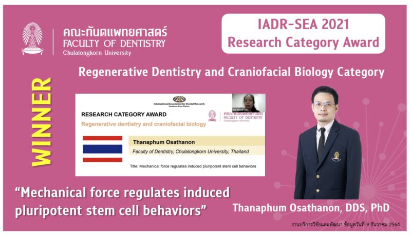 IADR Award 2022 1 scaled 800x461 1 คณะทันตแพทยศาสตร์ จุฬาลงกรณ์มหาวิทยาลัย