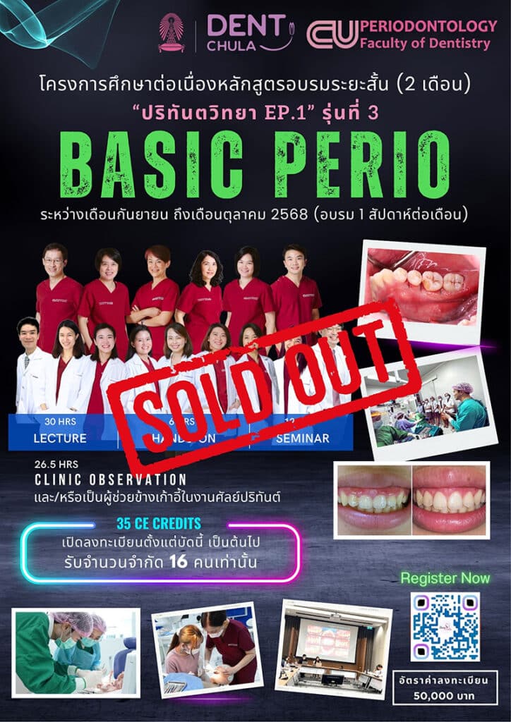 basic perio poster soldout คณะทันตแพทยศาสตร์ จุฬาลงกรณ์มหาวิทยาลัย