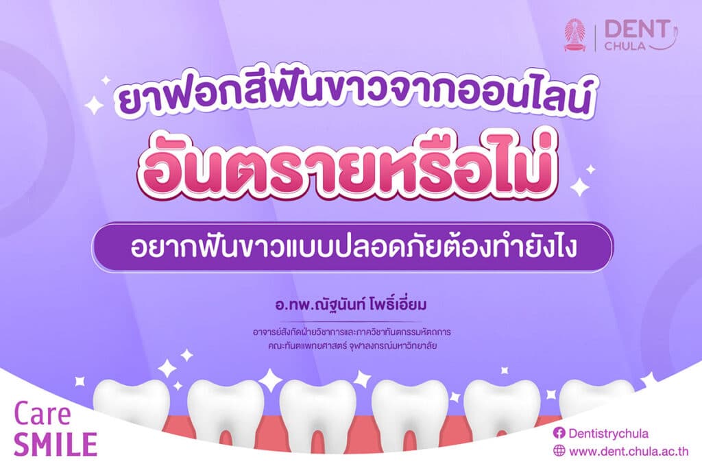 ยาฟอกสีฟันขาวจากออนไลน์ 01 0 คณะทันตแพทยศาสตร์ จุฬาลงกรณ์มหาวิทยาลัย