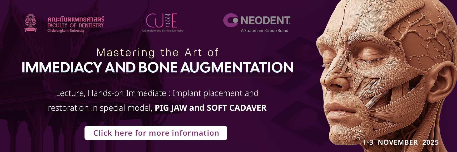 banner Neodent Immediate Implant Workshop คณะทันตแพทยศาสตร์ จุฬาลงกรณ์มหาวิทยาลัย