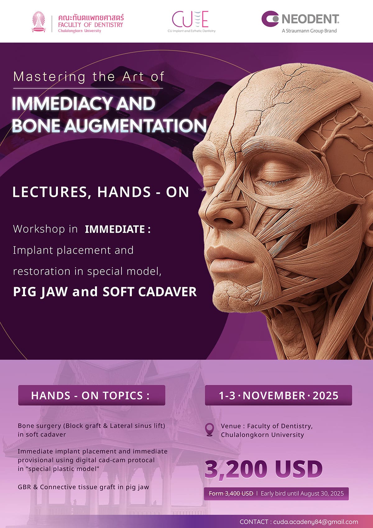 Immediate Implant Workshop with Cadaver Training