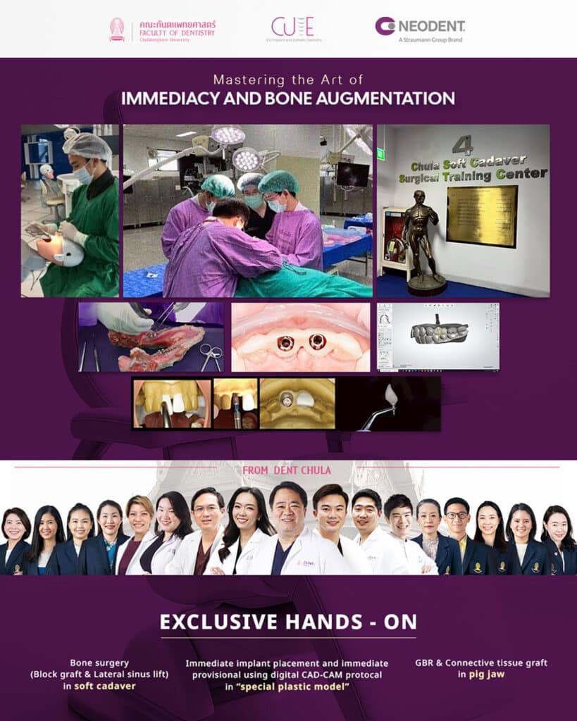 rs neodent S2.2 คณะทันตแพทยศาสตร์ จุฬาลงกรณ์มหาวิทยาลัย