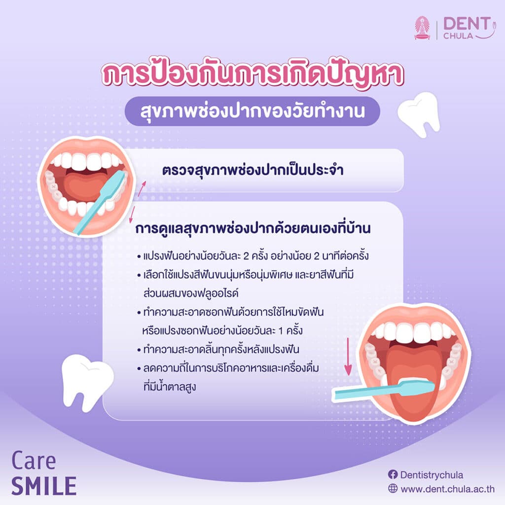 การป้องกันการเกิดปัญหาสุขภาพช่องปากของวัยทำงาน