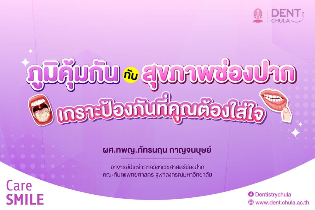 ภูมิคุ้มกันกับสุขภาพช่องปาก 01 0 คณะทันตแพทยศาสตร์ จุฬาลงกรณ์มหาวิทยาลัย
