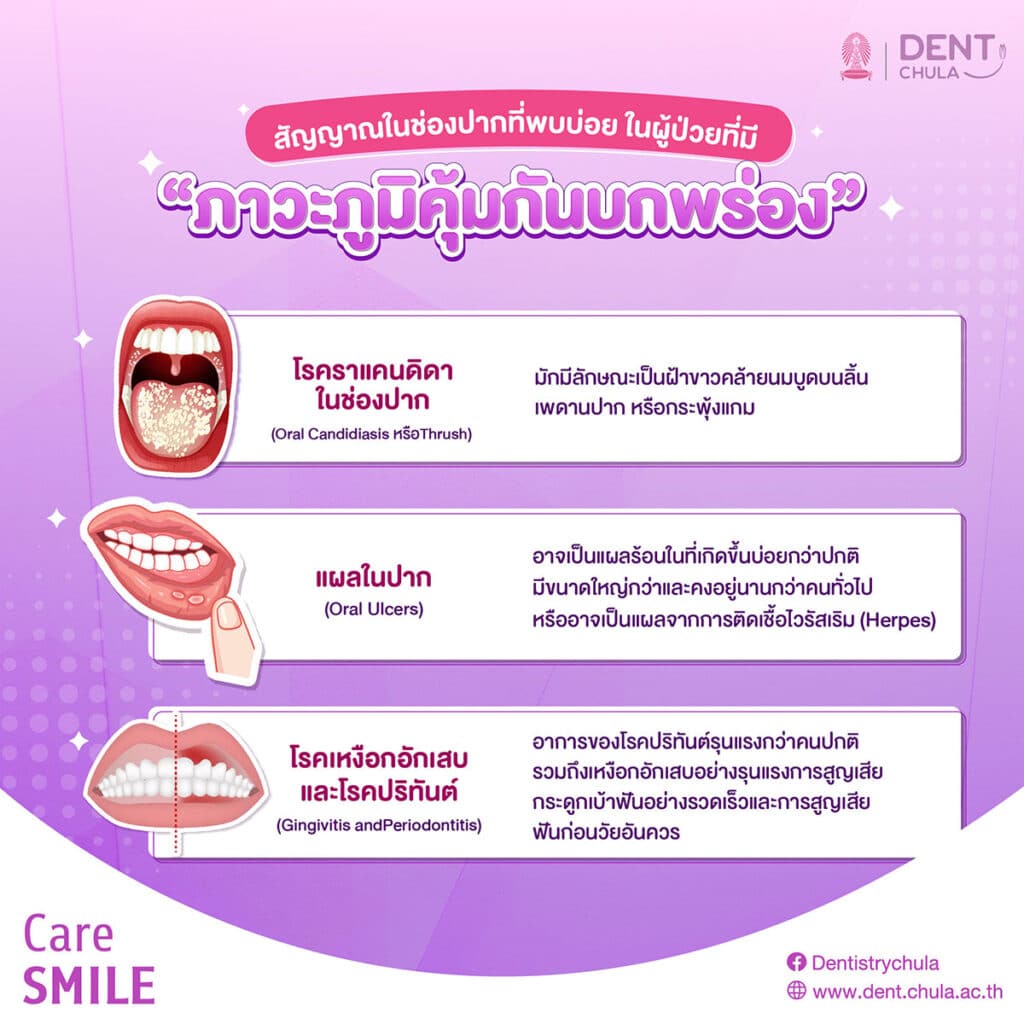 ภูมิคุ้มกันกับสุขภาพช่องปาก 03 0 คณะทันตแพทยศาสตร์ จุฬาลงกรณ์มหาวิทยาลัย