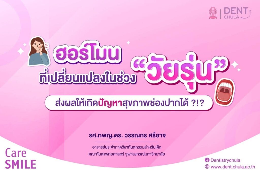 ฮอร์โมนที่เปลี่ยนแปลงในช่วง วัยรุ่น 01 คณะทันตแพทยศาสตร์ จุฬาลงกรณ์มหาวิทยาลัย