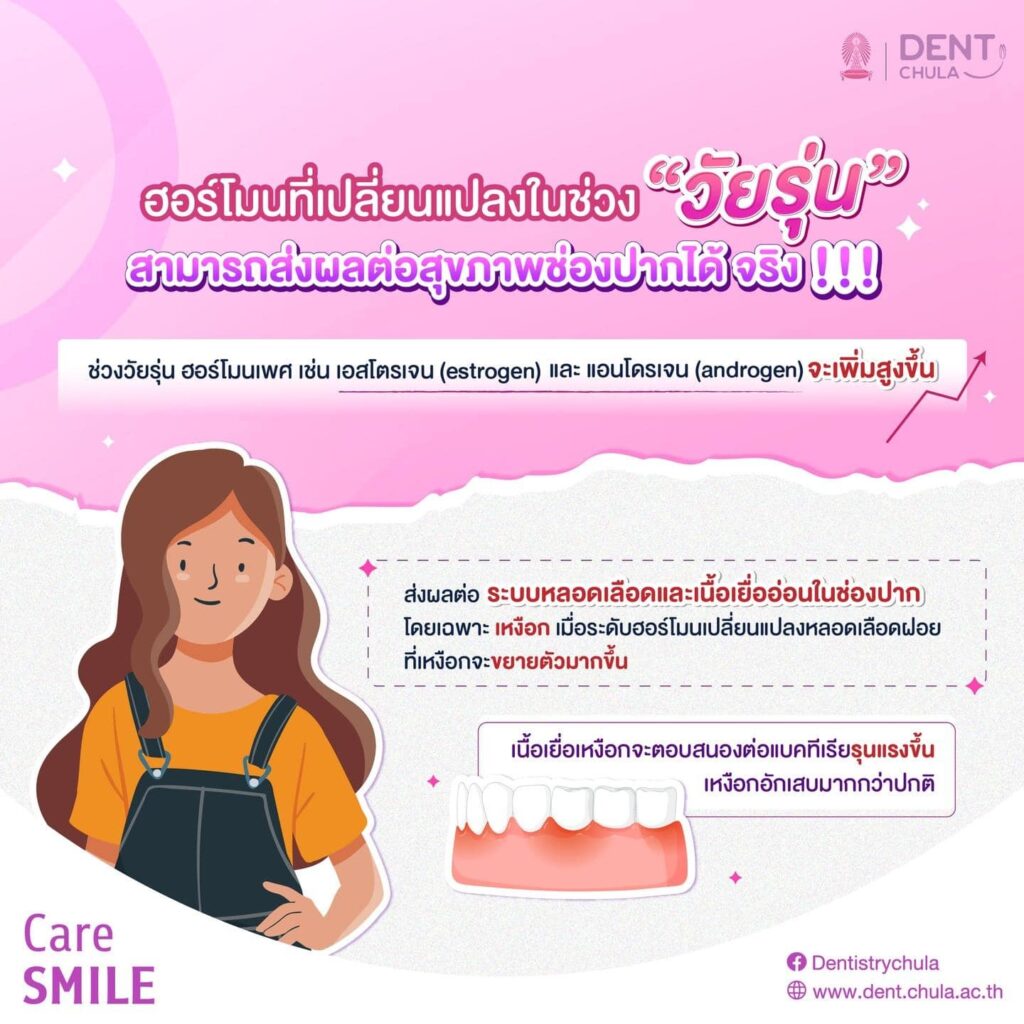ฮอร์โมนที่เปลี่ยนแปลงในช่วงวัยรุ่นสามารถส่งผลต่อสุขภาพช่องปากได้จริง