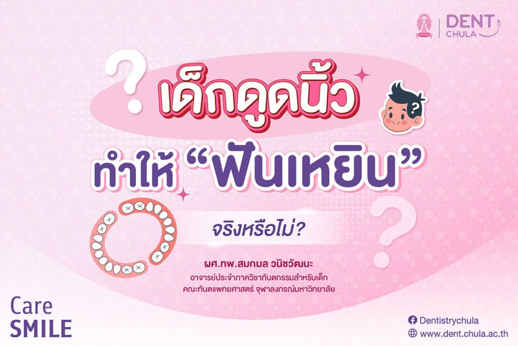 เด็กดูดนิ้วมือ 01 คณะทันตแพทยศาสตร์ จุฬาลงกรณ์มหาวิทยาลัย