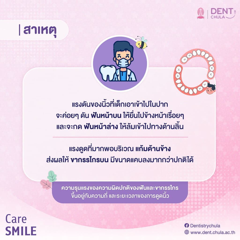 สาเหตุที่การดูดนิ้วส่งผลต่อการเรียงตัวของฟันและรูปร่างของขากรรไกร