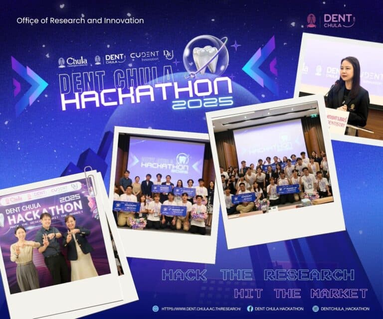 คณะทันตแพทยศาสตร์ จุฬาฯ จัดงาน “DENT CHULA HACKATHON 2025”
