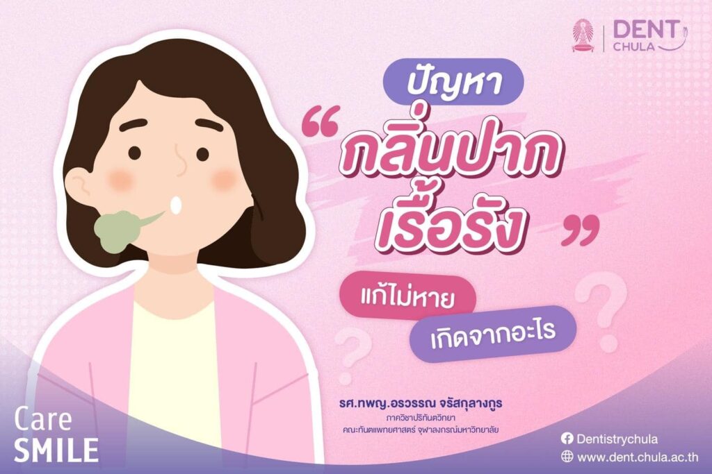 กลิ่นปากเรื้อรัง 01 คณะทันตแพทยศาสตร์ จุฬาลงกรณ์มหาวิทยาลัย