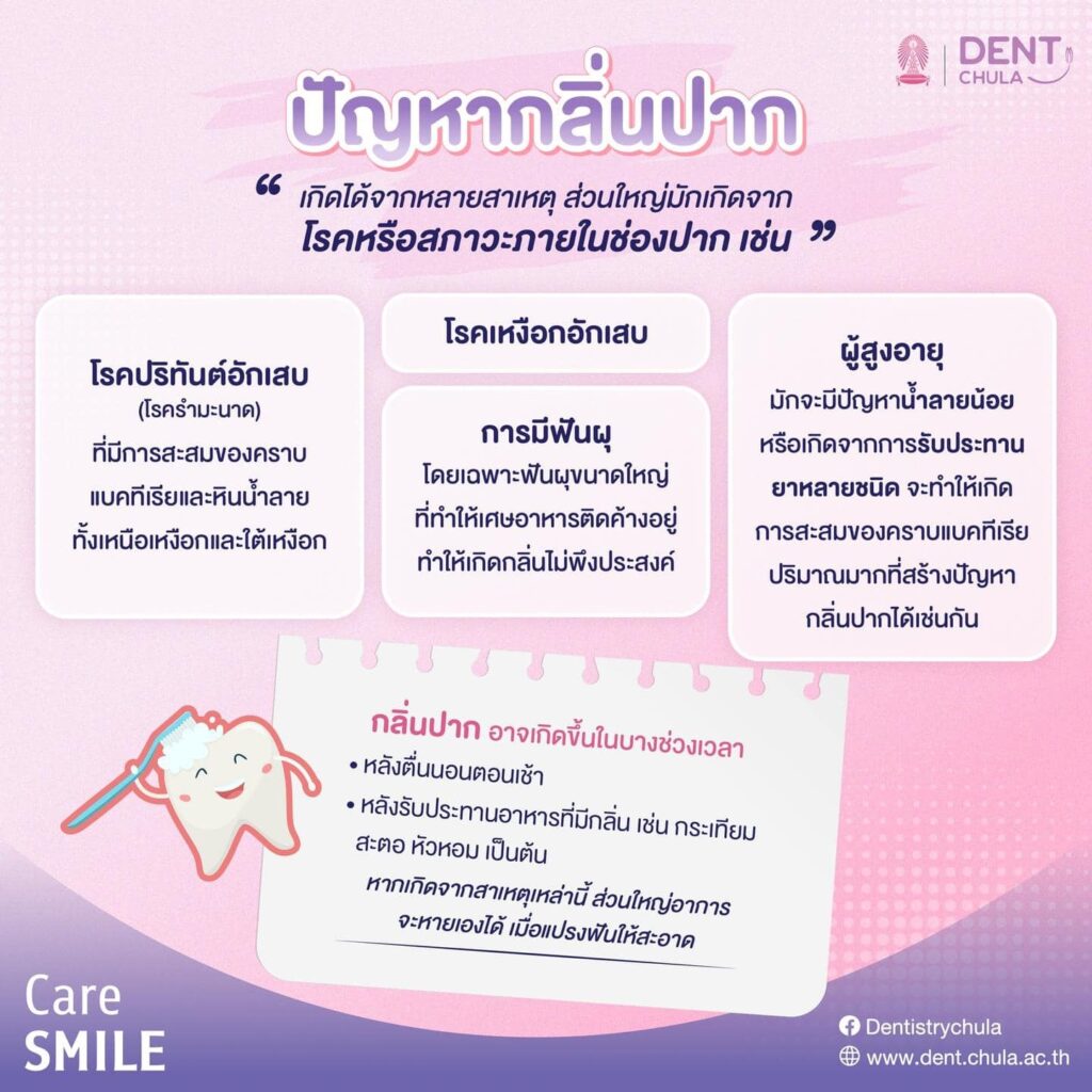 กลิ่นปากเรื้อรัง 02 คณะทันตแพทยศาสตร์ จุฬาลงกรณ์มหาวิทยาลัย