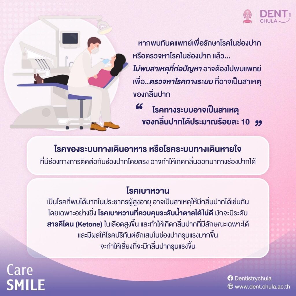 กลิ่นปากเรื้อรัง 03 คณะทันตแพทยศาสตร์ จุฬาลงกรณ์มหาวิทยาลัย
