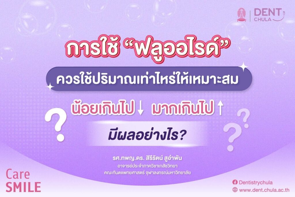 การใช้ฟลูออไรด์ 01 คณะทันตแพทยศาสตร์ จุฬาลงกรณ์มหาวิทยาลัย