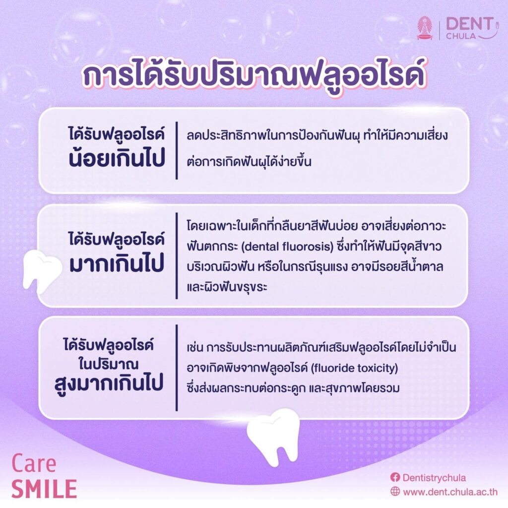 การใช้ฟลูออไรด์ 03 คณะทันตแพทยศาสตร์ จุฬาลงกรณ์มหาวิทยาลัย