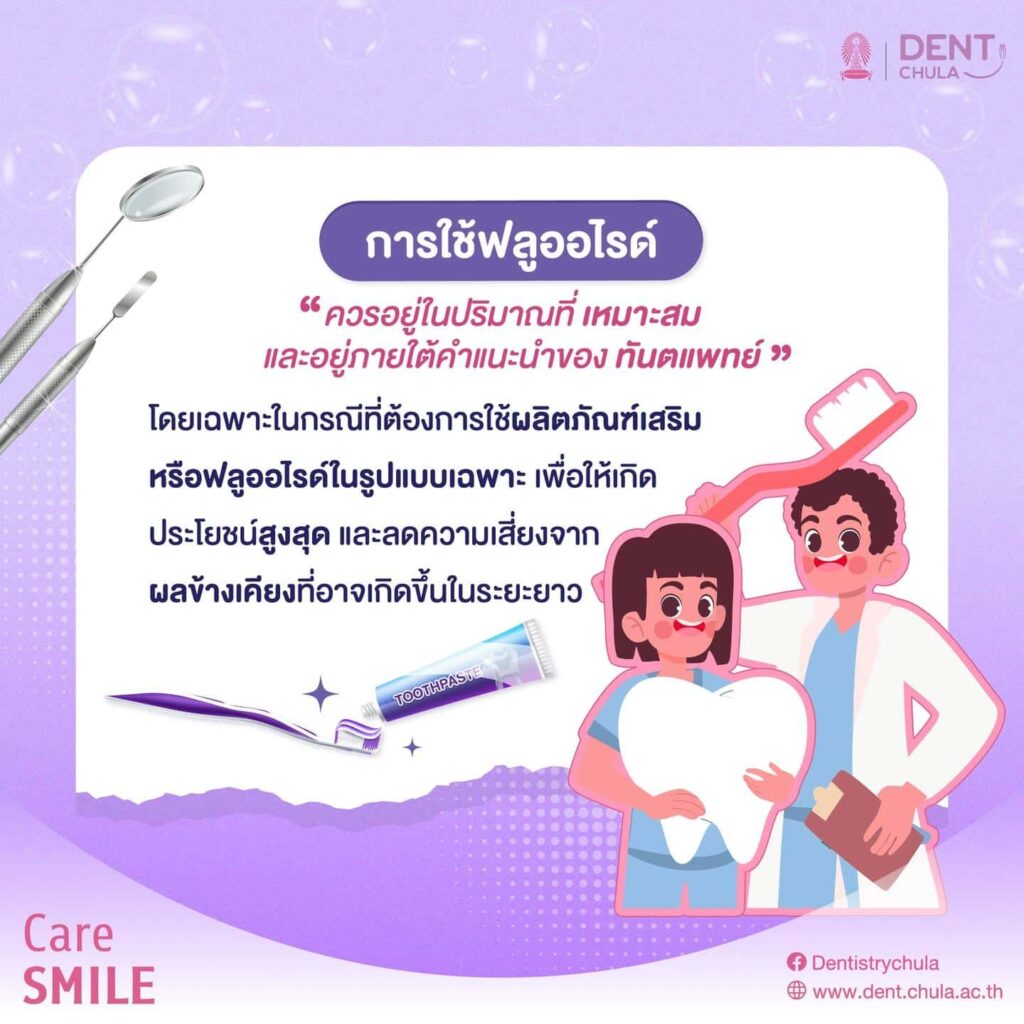 การใช้ฟลูออไรด์ 04 คณะทันตแพทยศาสตร์ จุฬาลงกรณ์มหาวิทยาลัย