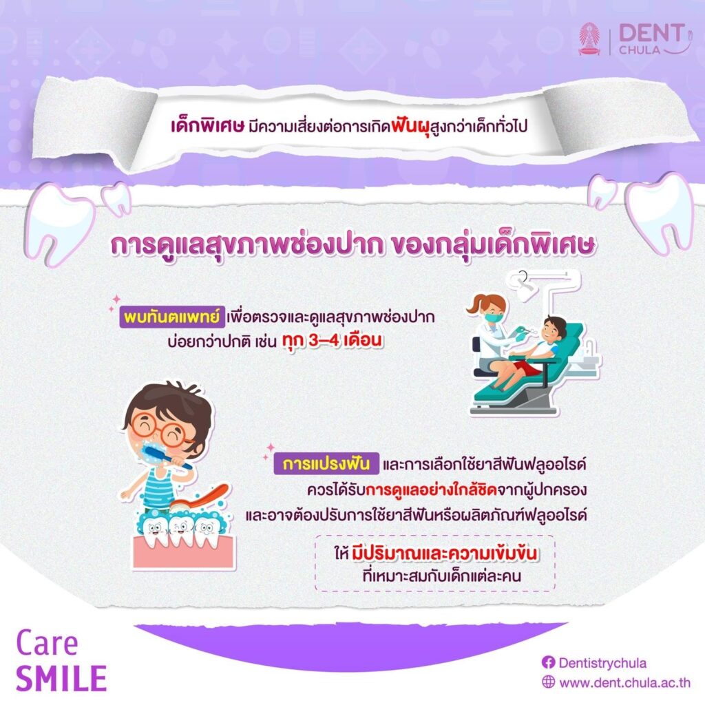 ช่องปาก ของกลุ่มเด็กพิเศษ 03 คณะทันตแพทยศาสตร์ จุฬาลงกรณ์มหาวิทยาลัย